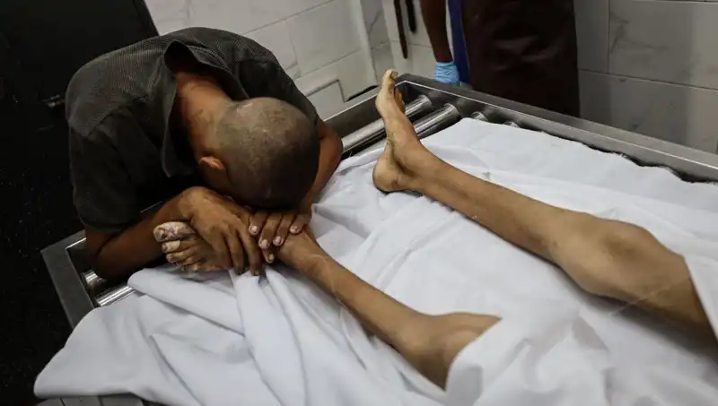 Gazze'de Çocuklar Açlıkla Savaşırken Bir Hayat Daha Kaybedildi